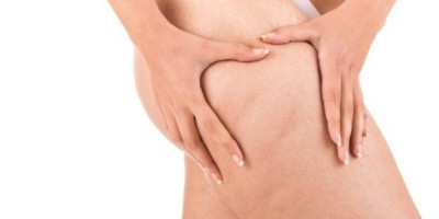 Celulites: como preveni-las e eliminá-las?