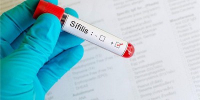 Fique atento para a sífilis