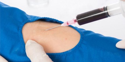 Quais cuidados devem ser tomados antes do exame de sangue?