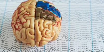 Morte cerebral: tudo que você precisa saber sobre o assunto!