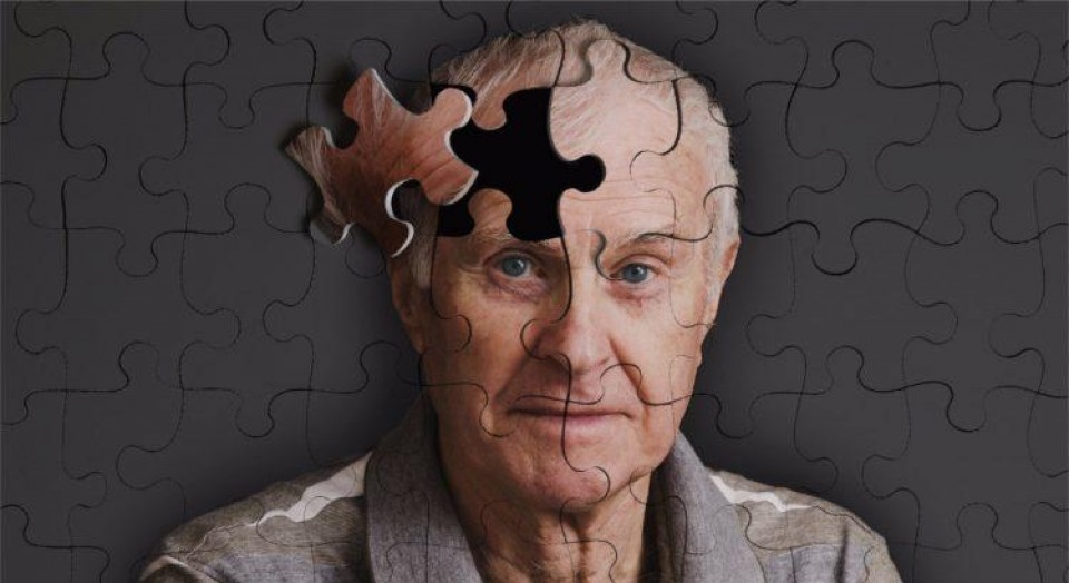 Alzheimer: tudo que você precisa saber!