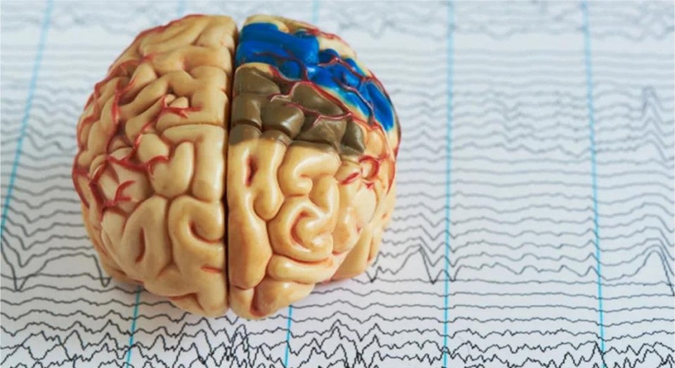 Morte cerebral: tudo que você precisa saber sobre o assunto!
