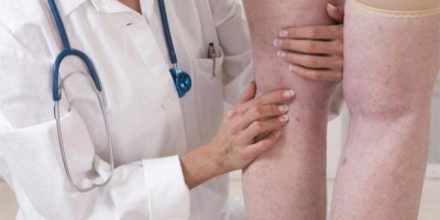 O que faz um angiologista? Conheça 5 doenças tratadas por esta especialidade! O que faz um angiologista? Conheça 5 doenças tratadas por esta especialidade!